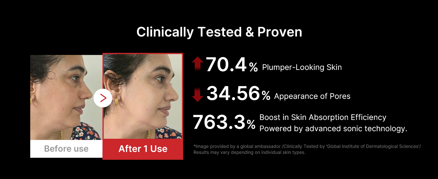 KEY BENEFITS OF BOOSTER H, KOREAN SKIN CARE DEVICE THAT MAXIMIZES SKIN CARE